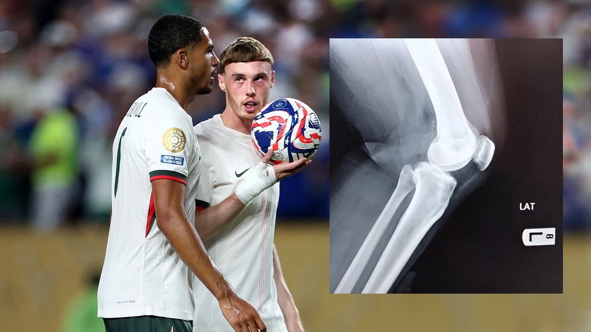 Ужас! Англичанин из «Челси» травмировался на первой же тренировке